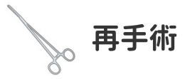 包茎手術の再手術が検討されるケースについて説明した項目のイラスト